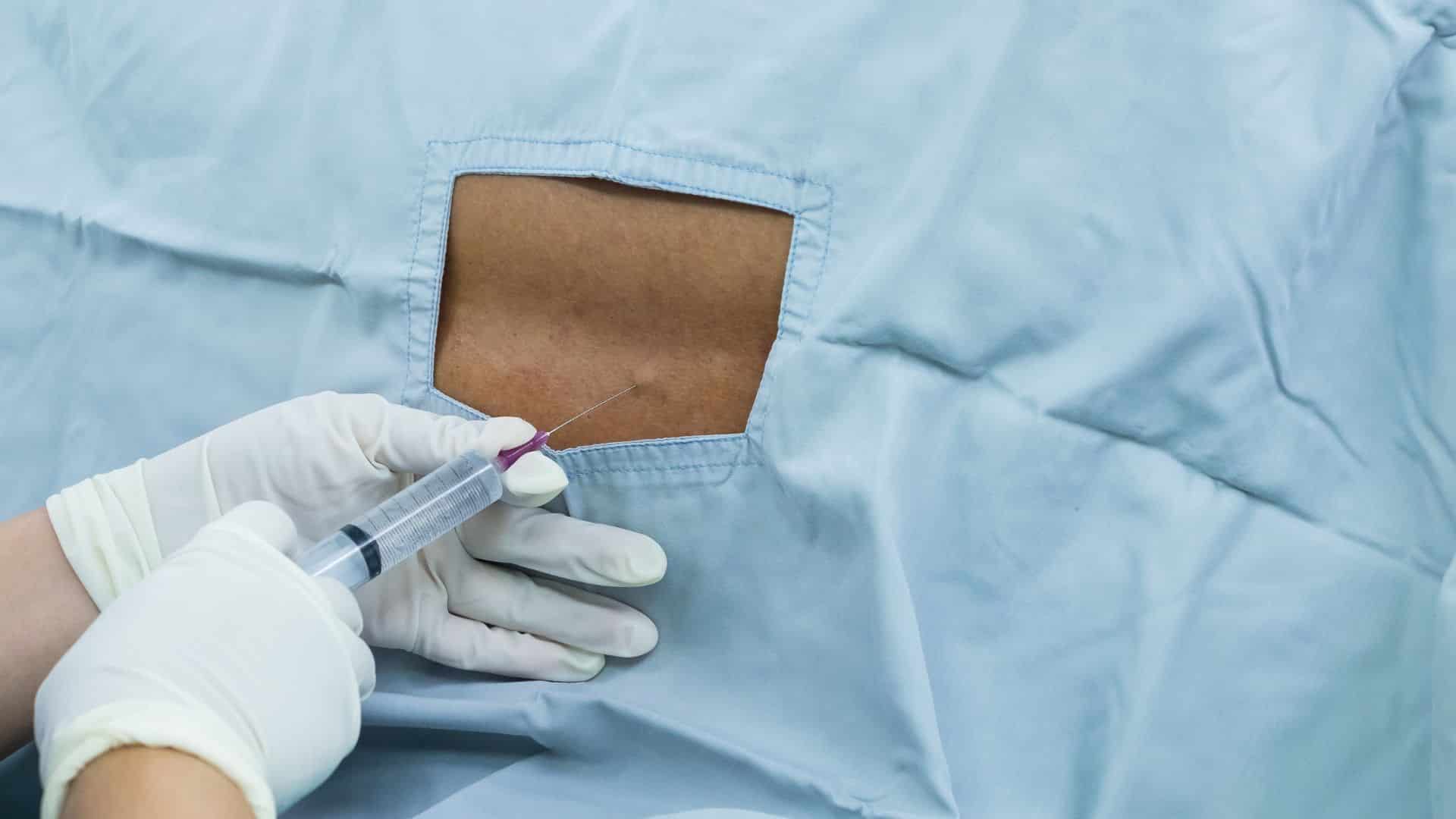 Pain Specialist Injecting Epidural Steroid Injection